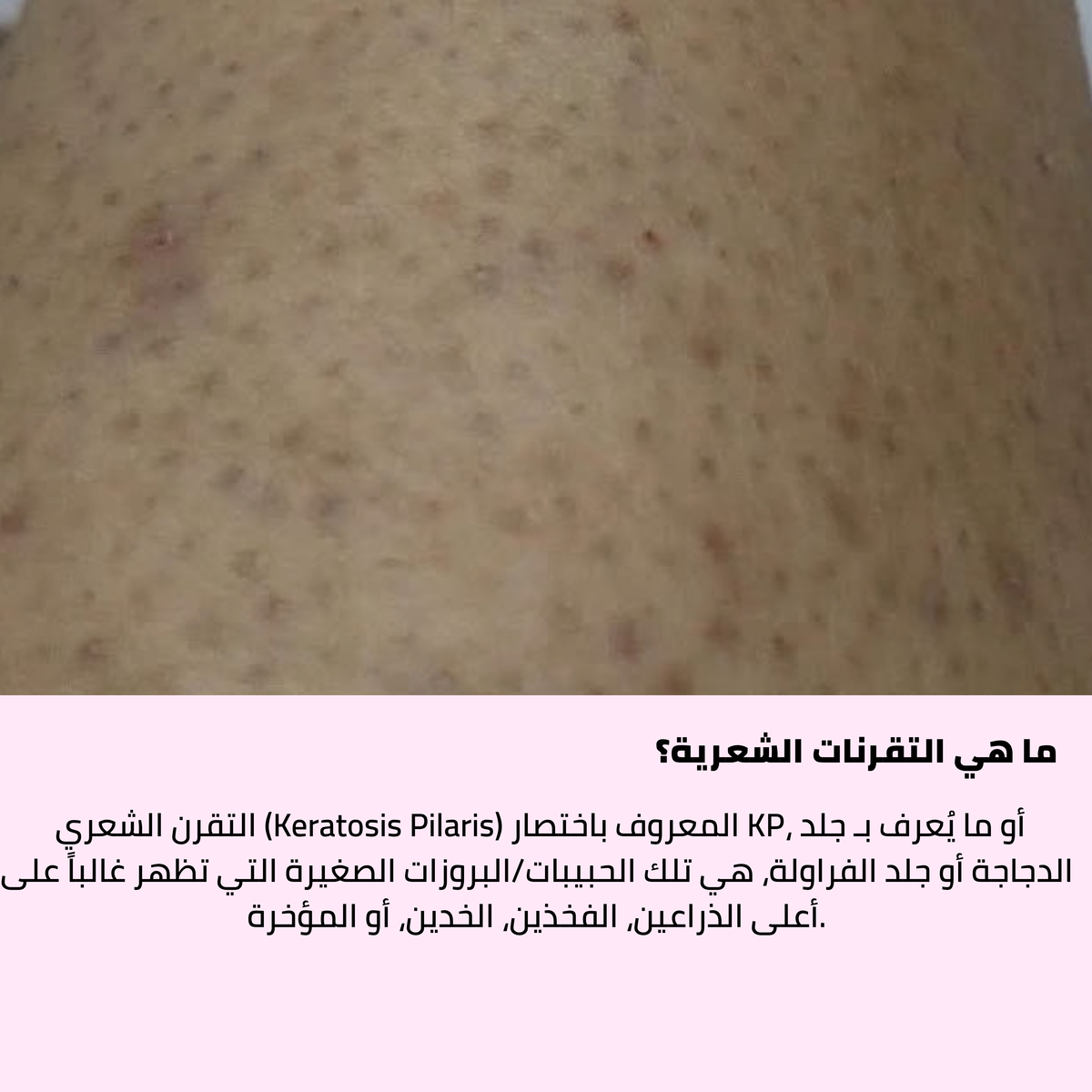 مقشر املاح الهيمالايا
